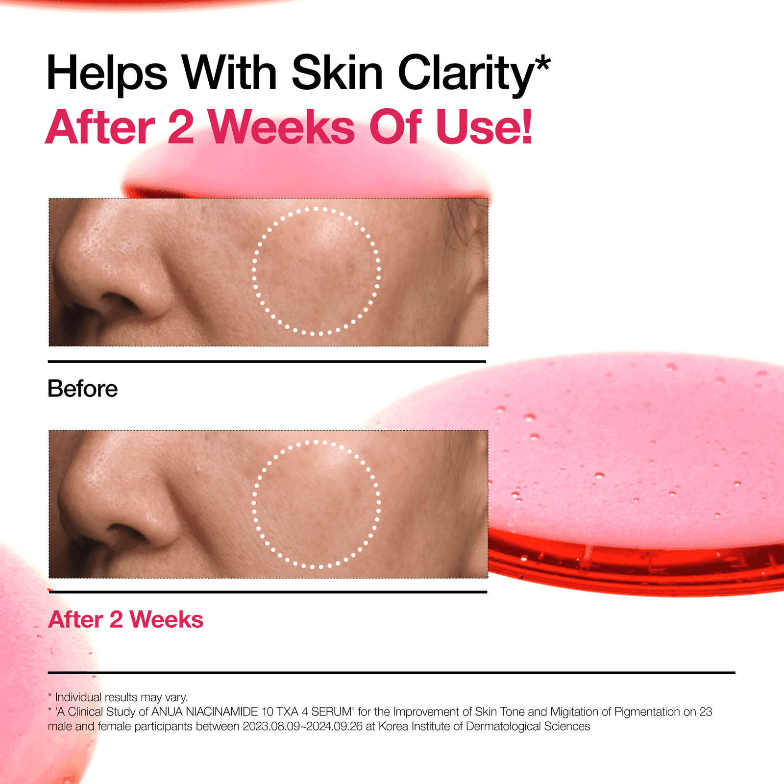 ANUA 10% Niacinamide + 4% Tranexamic Acid Serum  (30ml)