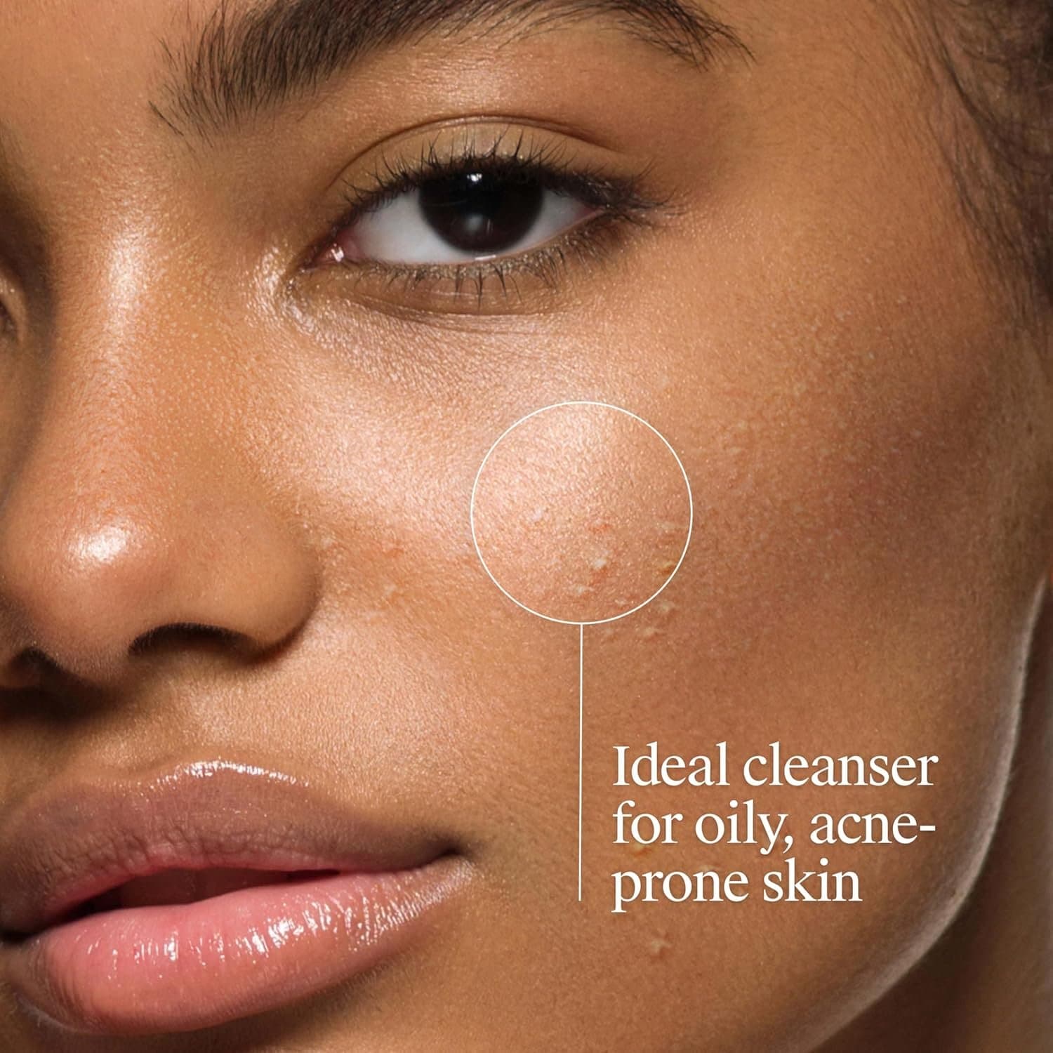 Neutrogena Oil-Free Acne Face Wash, Breakout Prone Skin Facial Cleanser with 2% Salicylic Acid Acne Treatment for Face