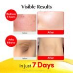 EQQUALBERRY Vitamin Illuminating Serum – Brightening Vitamin C Serum with Niacinamide | Strengthens skin barrier | Hydrates using Ceramide and Hyaluronic Acid, 1.01oz / 30ml - Image 4