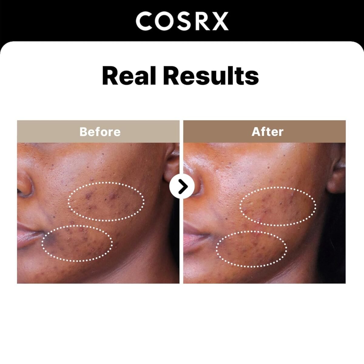 COSRX Alpha-Arbutin 2 Discoloration Care Serum - Image 2