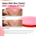 ANUA 10% Niacinamide + 4% Tranexamic Acid Serum  (30ml) - Image 4